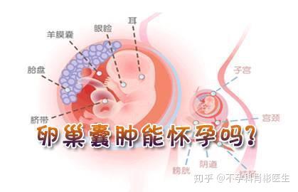 卵巢囊腫還能懷孕嗎不妨聽聽我的分析