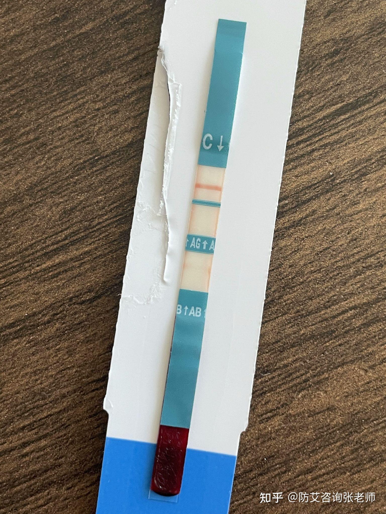 雅培四代试纸检测到底多久可以排除? - 知乎
