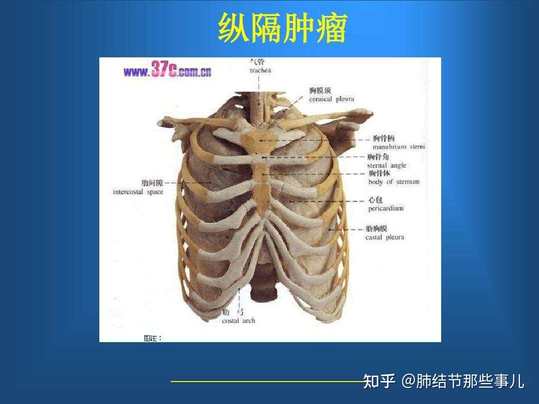 戴主任科普之纵隔肿瘤预防与治疗