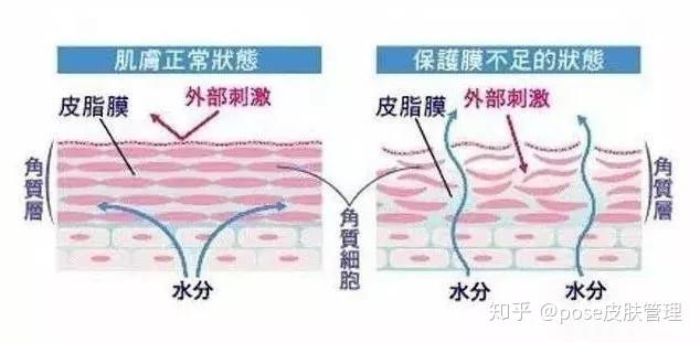 关于皮肤屏障功能 - 知乎