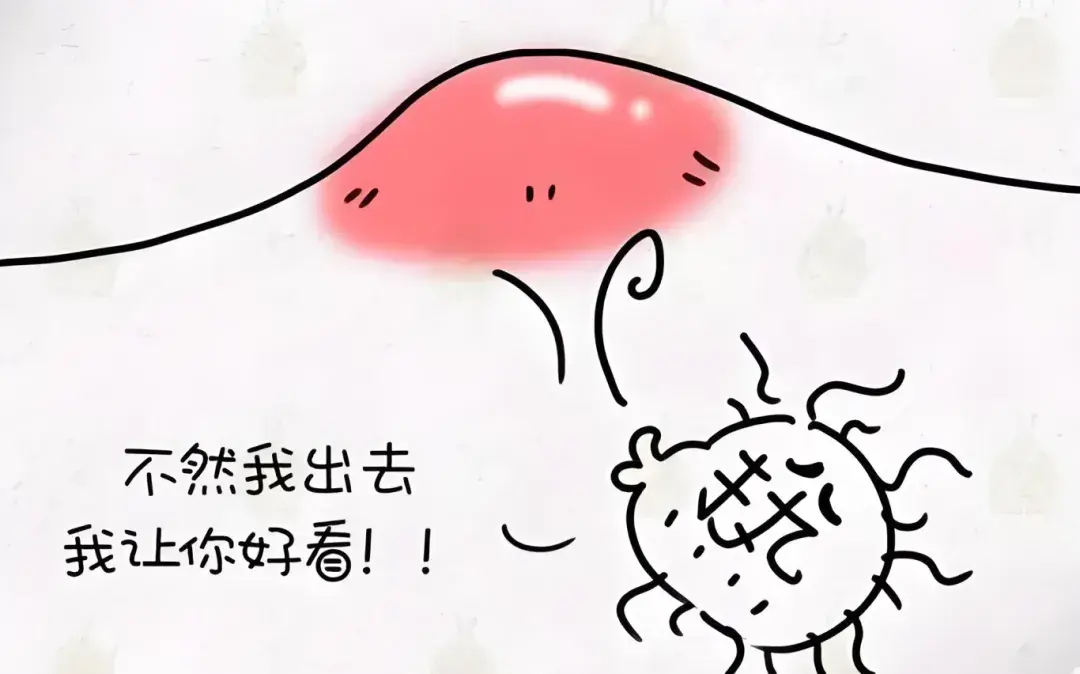 深度解析火疖子的成因、症状与科学处理办法。 - 知乎