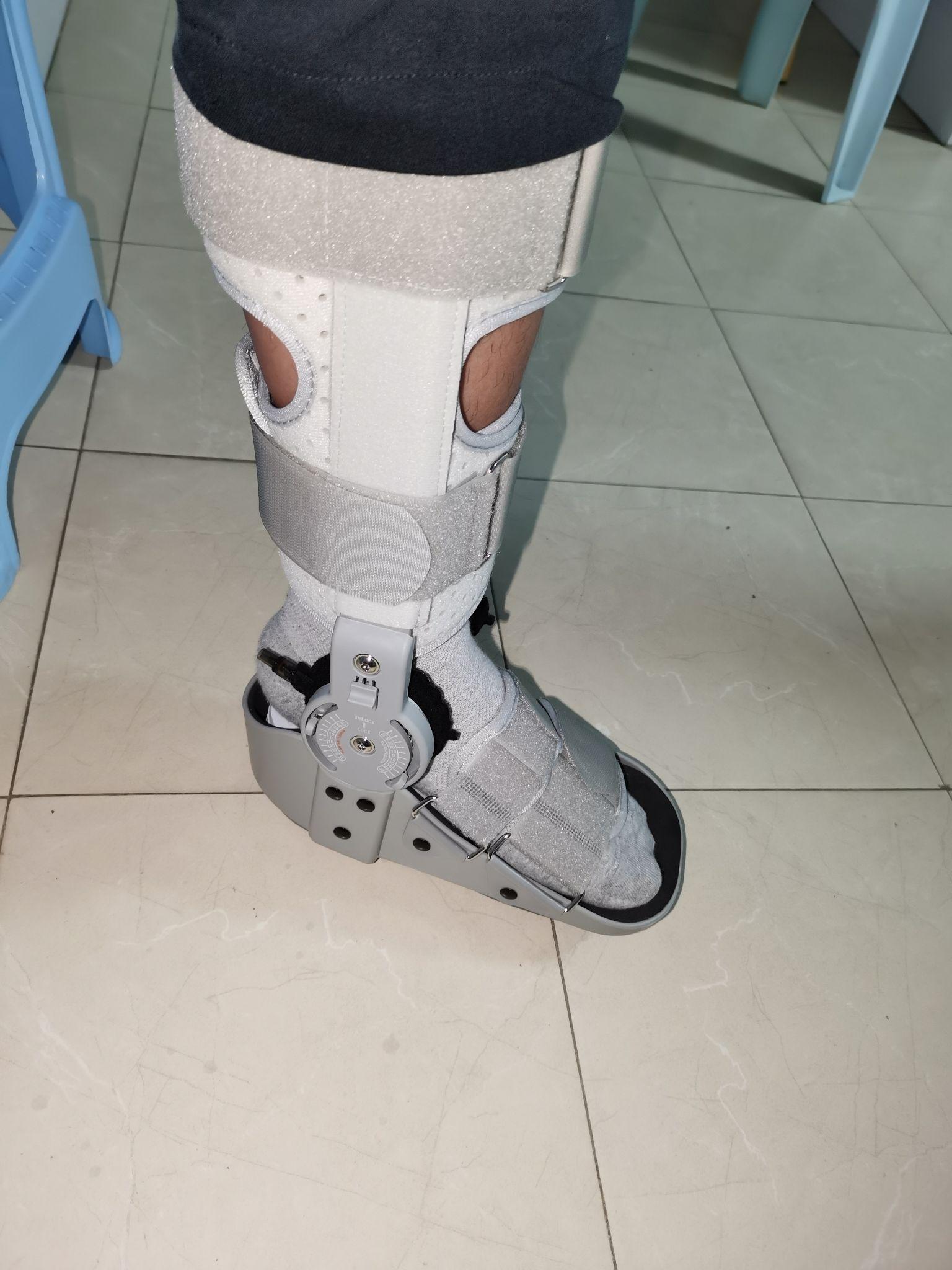 我的跟腱断裂手术及恢复过程