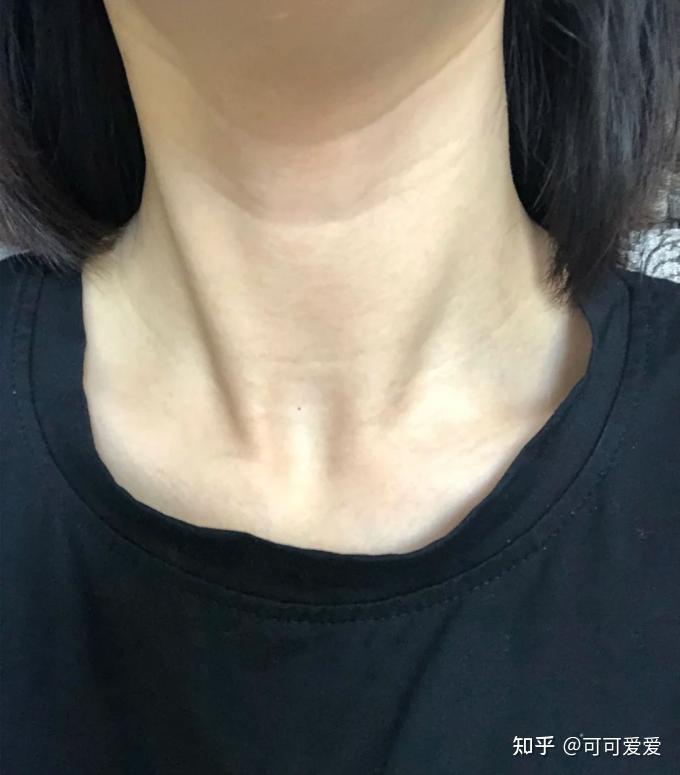 学生党上班族脖子美白去颈纹平价神器两个月天鹅颈养成计划