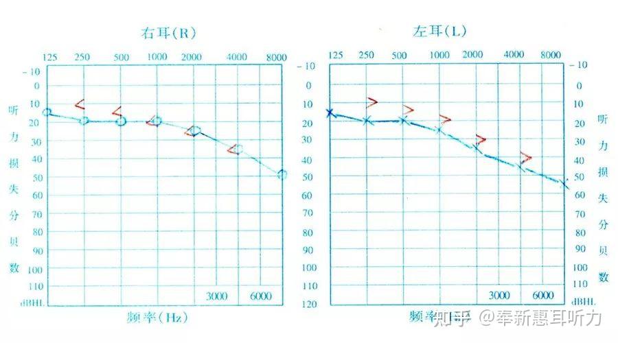 听得到,但听不清听不懂?你是这样吗? - 知乎