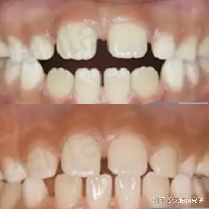 郑秀妍这段太蛊了吧!芒果台怎么能删了不播??!(郑秀妍签约英皇)