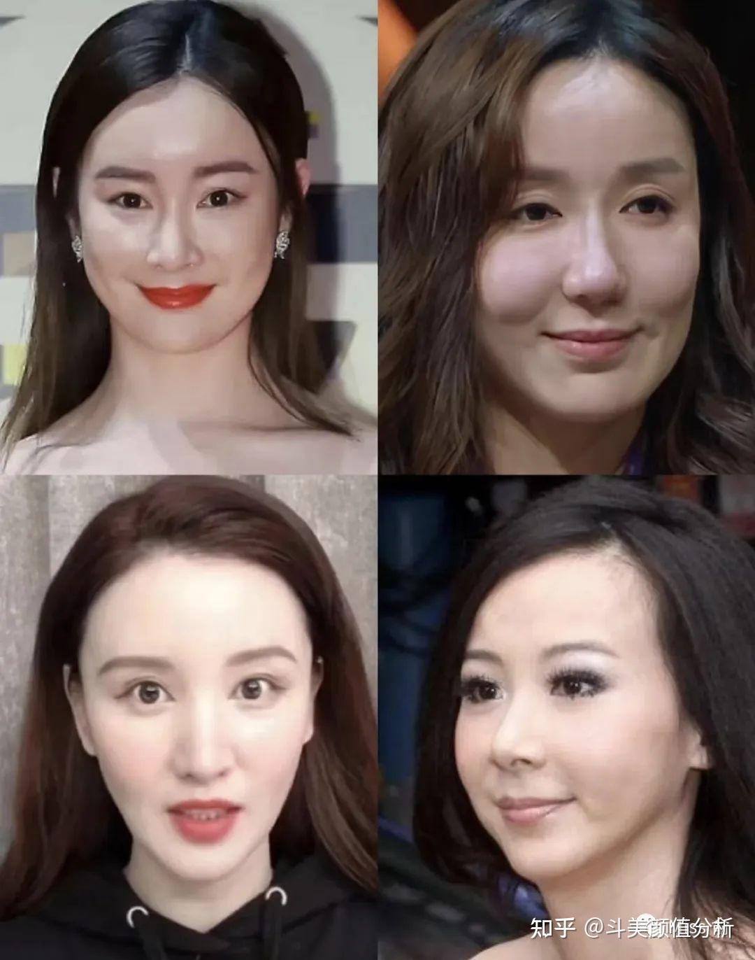 打玻尿酸脸部僵硬几年可以变回以前的谁知道啊? - 知乎