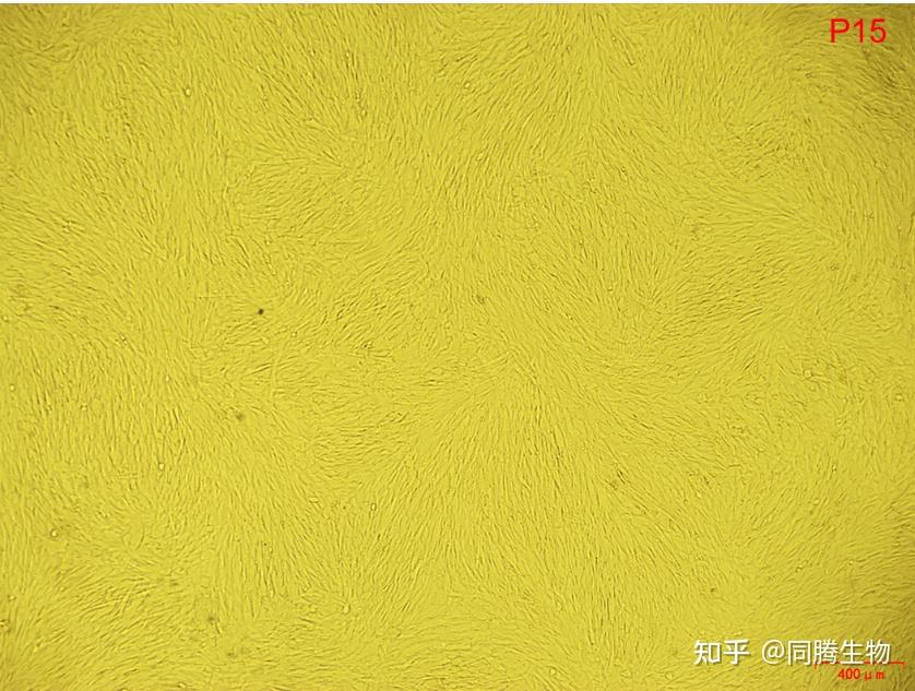 案例应用丨同腾新创msc培养基在间充质干细胞3d培养基中应用（上） 知乎 