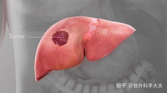zhuanlan.zhihu.com