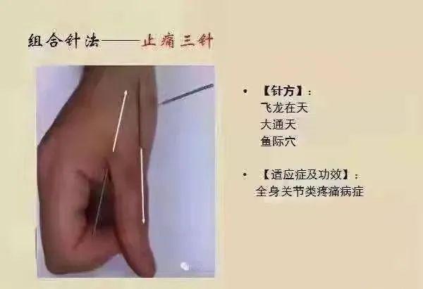 針灸:11 崴腳一針(比養老穴效果好):小節穴,朝大陵進針12 膝關節痛