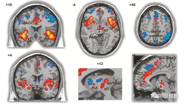 PFC网络在认知控制和执行功能中的作用 - 知乎