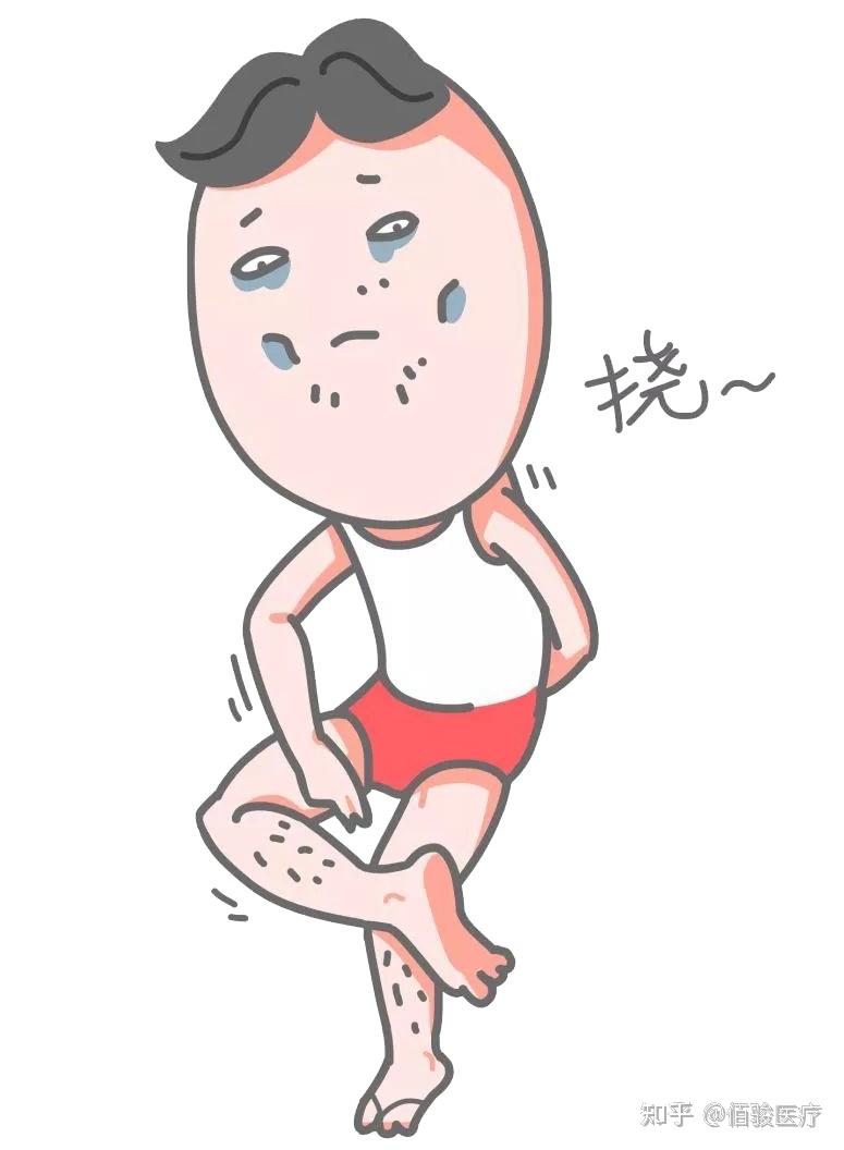 皮肤瘙痒