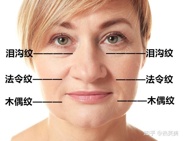 你还在被皱纹困扰吗?2分钟了解脸部皱纹的形成原因和祛除方法! - 知乎