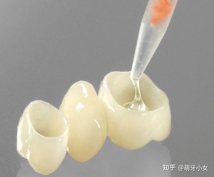 树脂补牙一般能用多久?