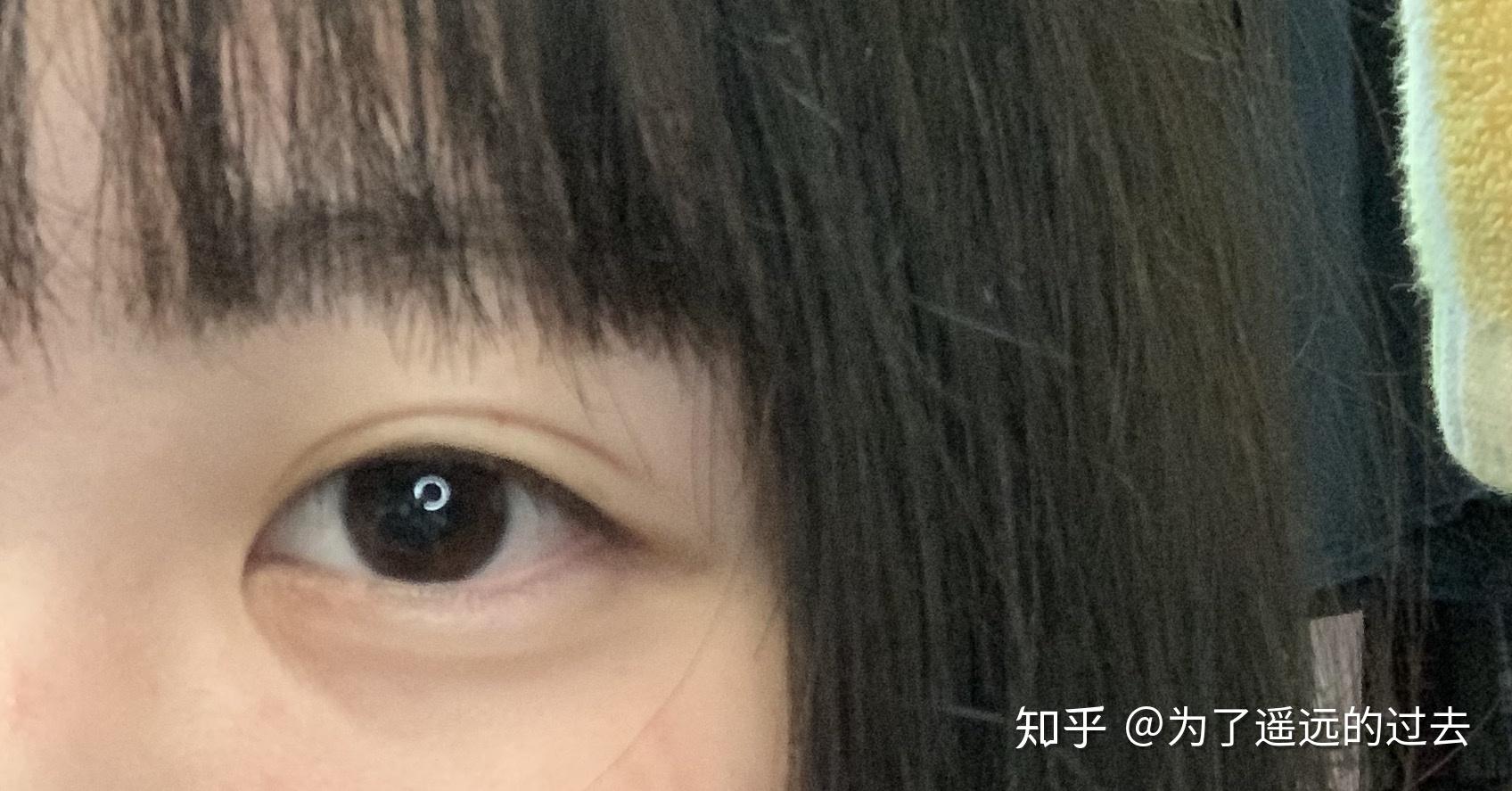 为什么有人说妖痣可怕,妖痣究竟长在哪里?