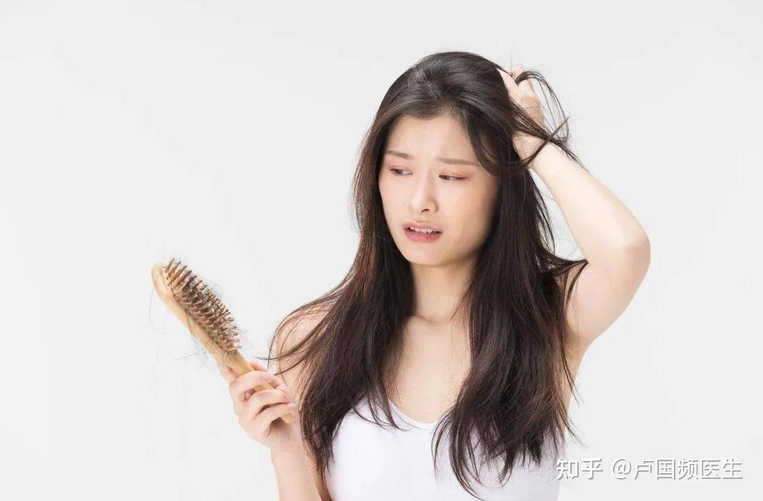 治疗脱发最怕盲目,随大流,医生:不想聪明“绝顶”,快进来看看 - 知乎
