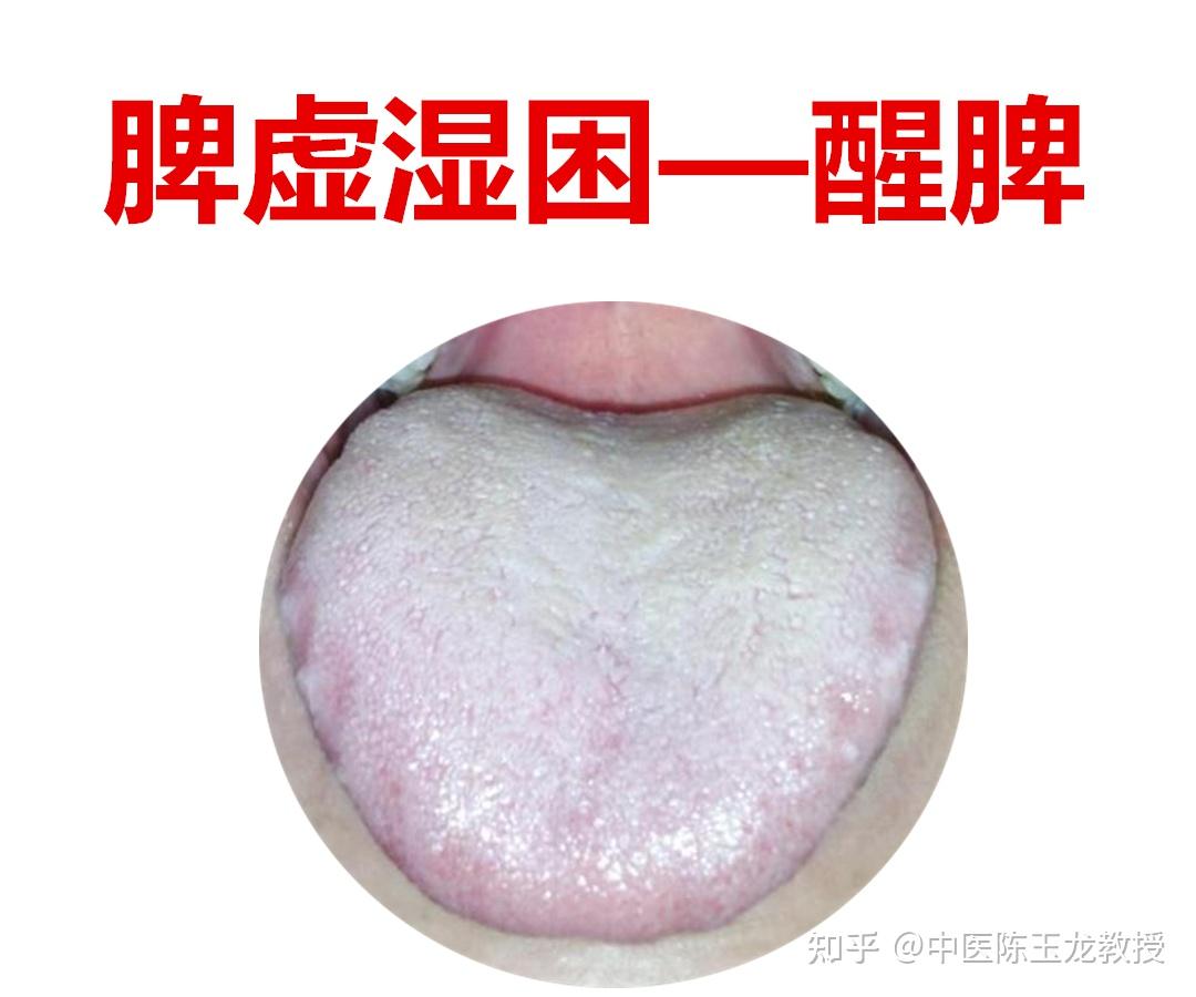 脾虚百病生,老中医教你几个养脾妙招,养好脾胃不生病 - 知乎