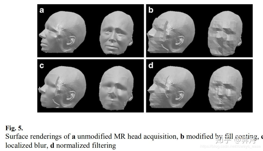 obscuring surface anatomy in volumetric imaging data