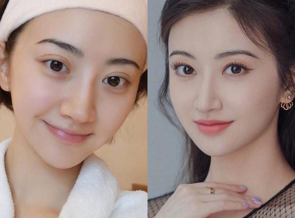 割的双眼皮和自然的双眼皮有什么区别?