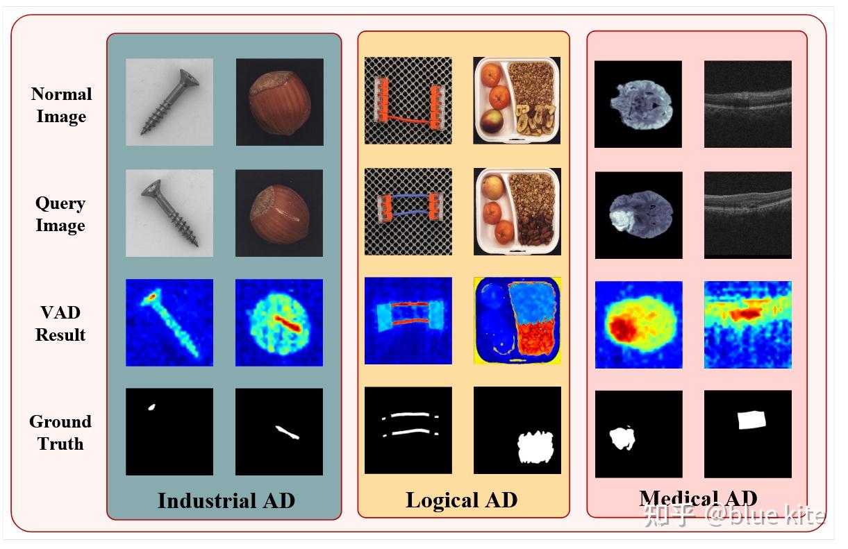 Visual Math Anomalies 【小样本异常检测】UniVAD: A Training-free Unified Model for Few-shot Visual ...