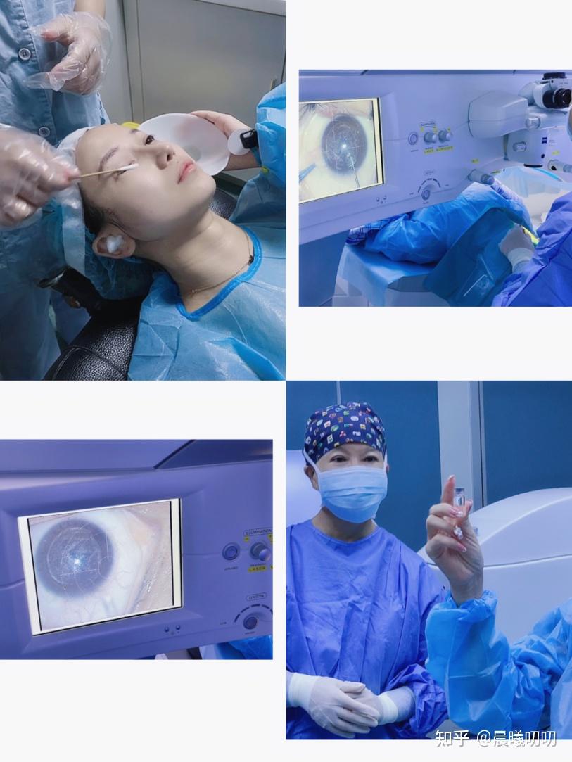 我做近视眼手术后生活有哪些变化