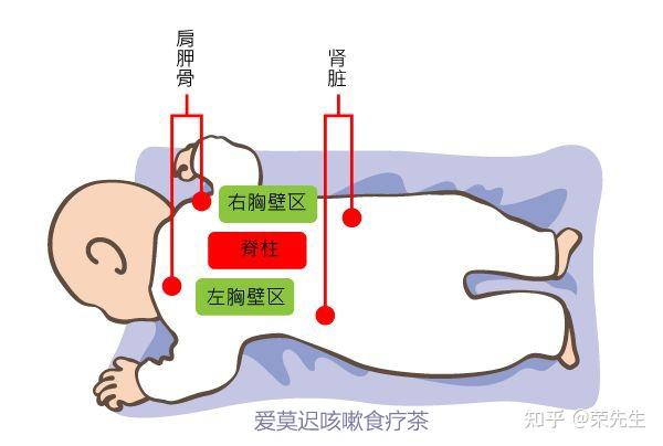 拍背排痰手法寶寶咳嗽拍痰止咳方法