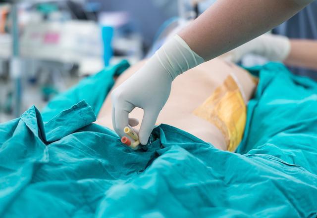 导尿下胃管习以为常病人!