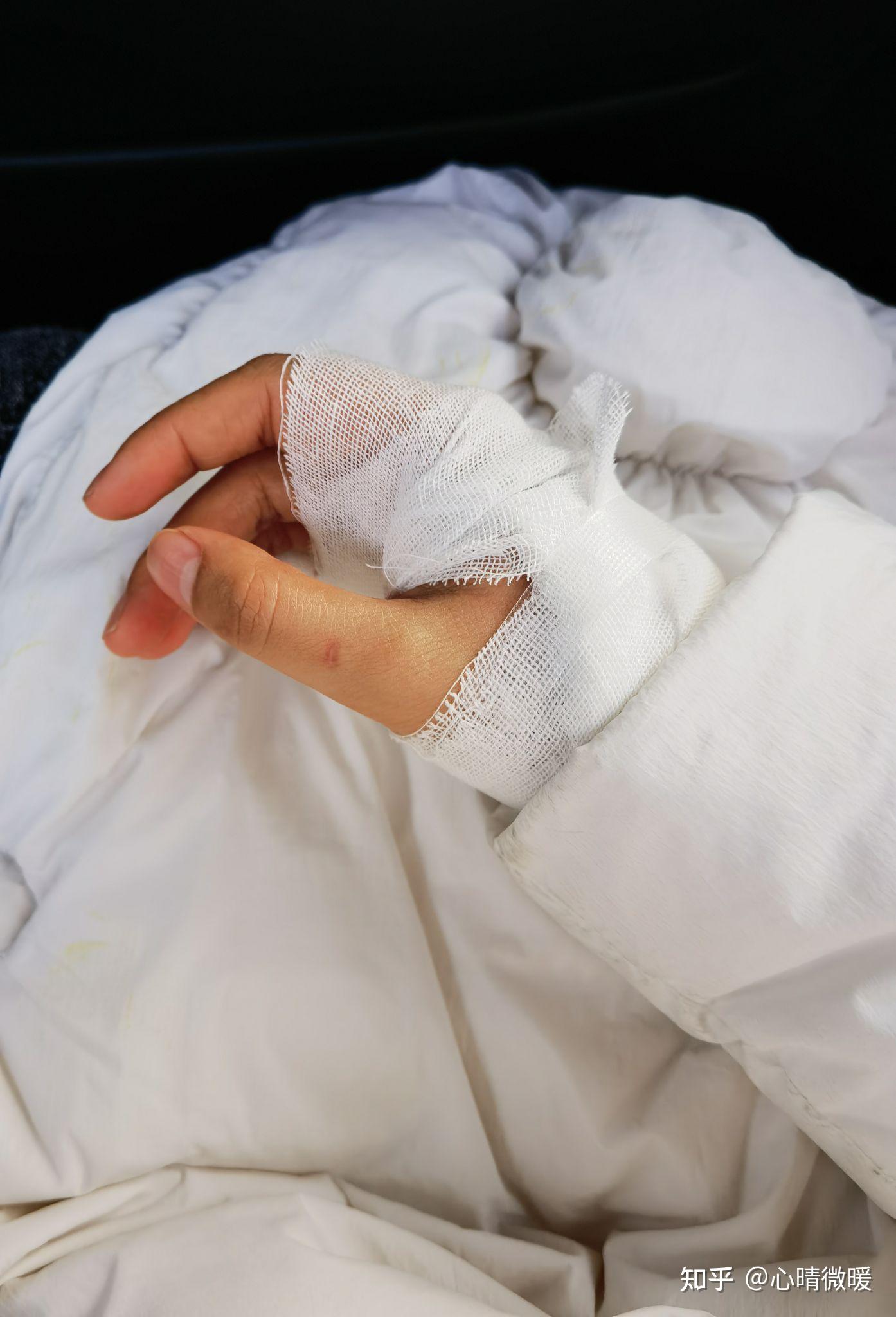 打狂犬病疫苗后感