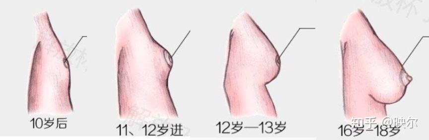 12岁女孩乳房发育标准图片
