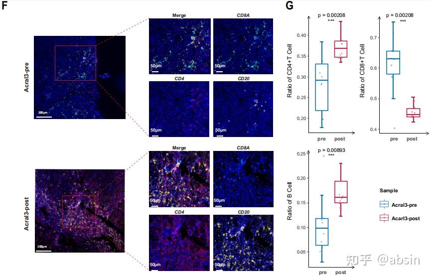 多色文献分享：探究黑色素瘤的肿瘤免疫微环境 - 知乎