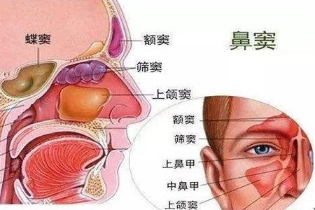 首大陈潜:鼻窦炎正确的体位引流方法及按摩方法 - 知乎