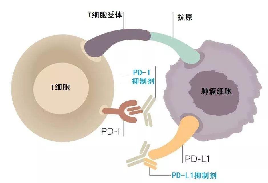 熱腫瘤:腫瘤組織附近已經聚集了不少免疫細胞,免疫細胞已經在這裡跟癌