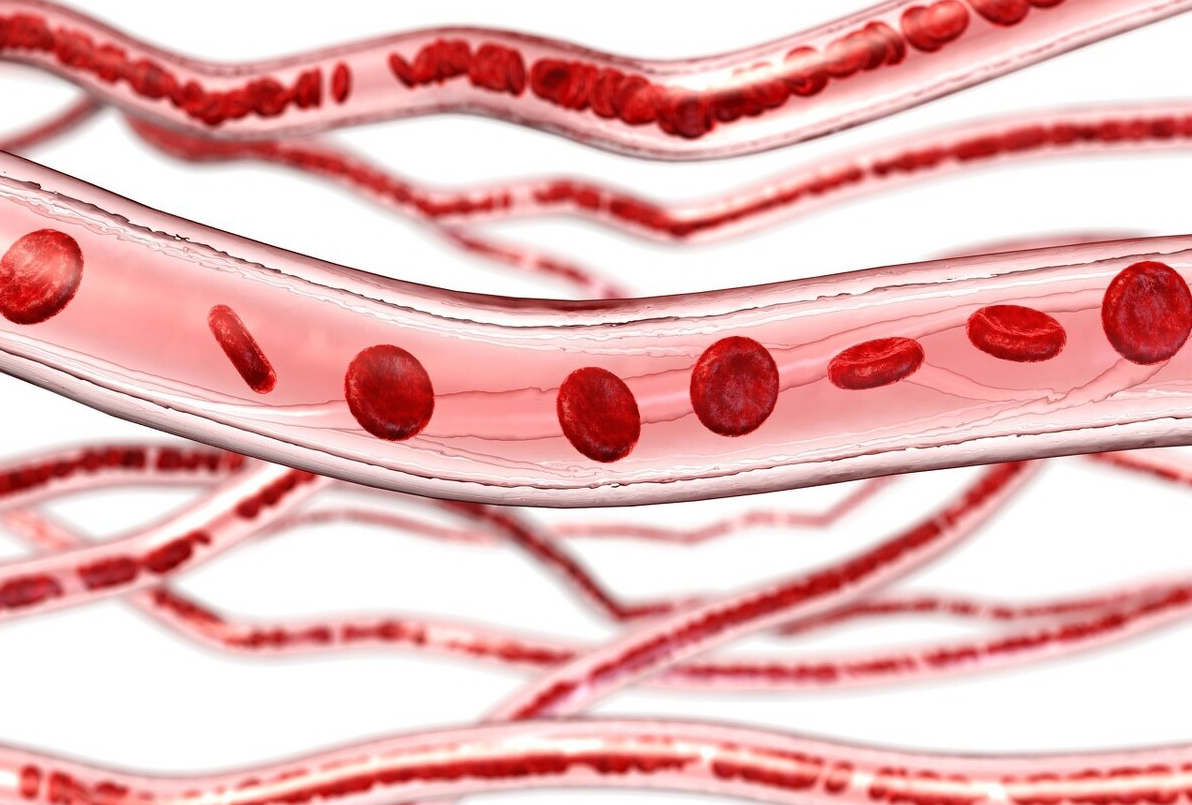起床后出现这5个信号,可能是血管在向你求救!