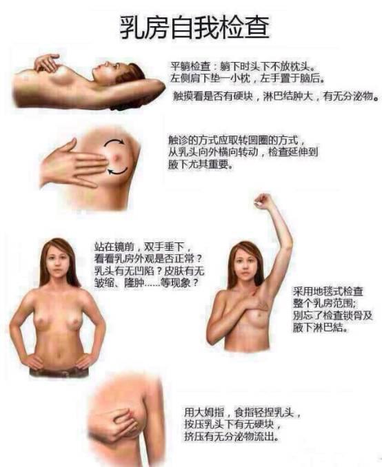 乳房问题自测 知乎