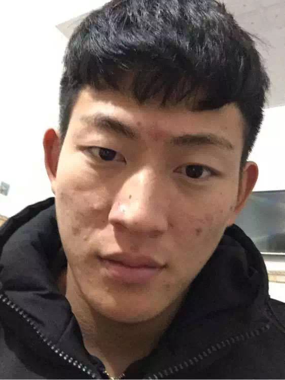 戒色对比图 | 两位戒色一月左右变化极大，戒上一年直接逆袭 - 知乎