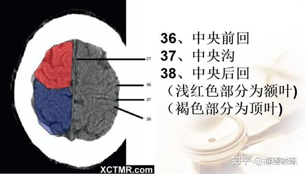 解剖&影像 ~ 脑实质CT断层解剖 - 知乎