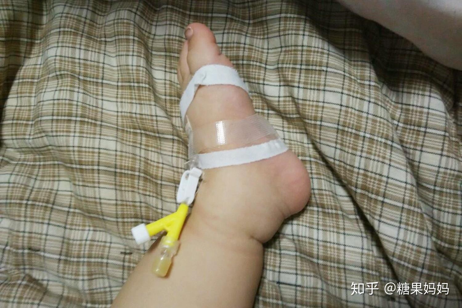 宝宝退热贴不好挑妈妈应该怎么选学会一闻两看是关键