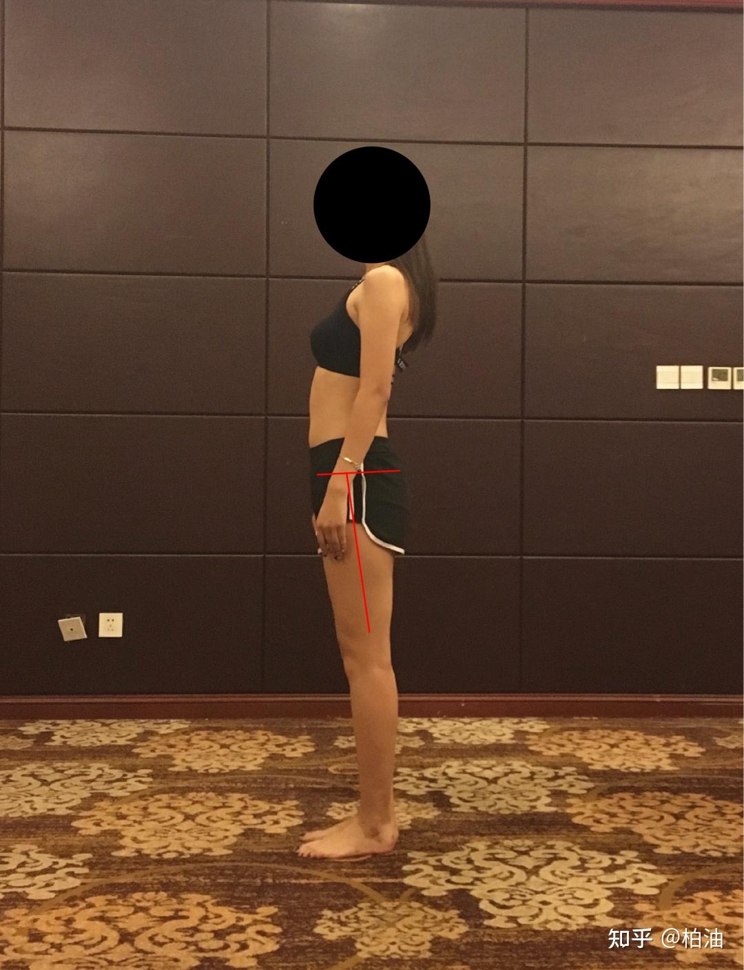 为什么骨盆前移的人髋关节可能是外旋的