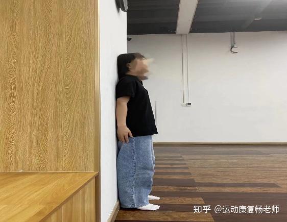 驼背怎么改善? - 知乎