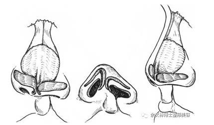 鼻前棘解剖图谱图片
