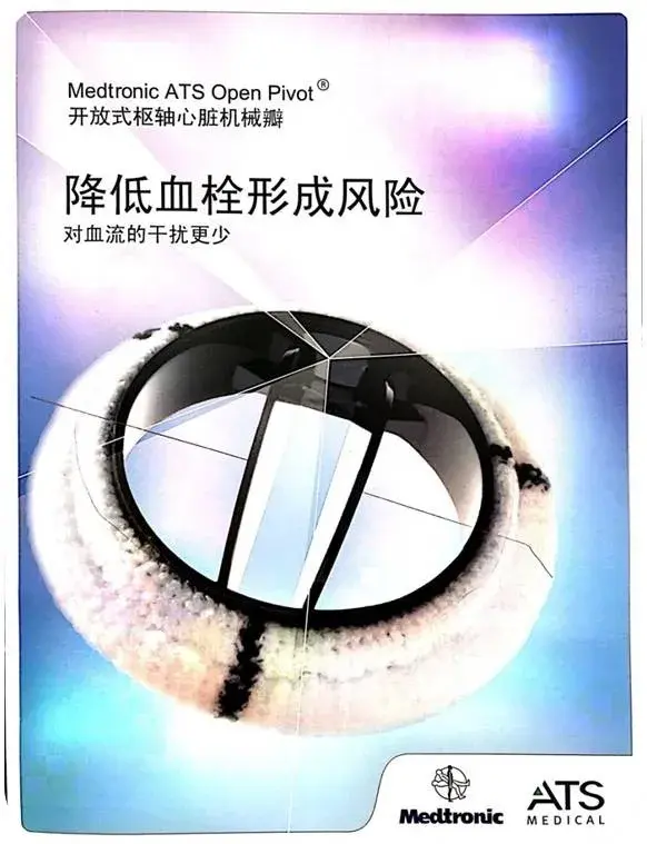 人工瓣膜出现后,至今已有多种机械瓣在临床应用.