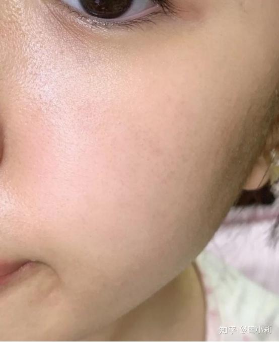 怎么收缩毛孔 - 知乎