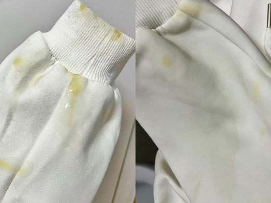 油渍弄到衣服上怎么洗干净啊?最好是不用洗整件衣服的办法!教你一招,顽固油渍也能轻松拿下!