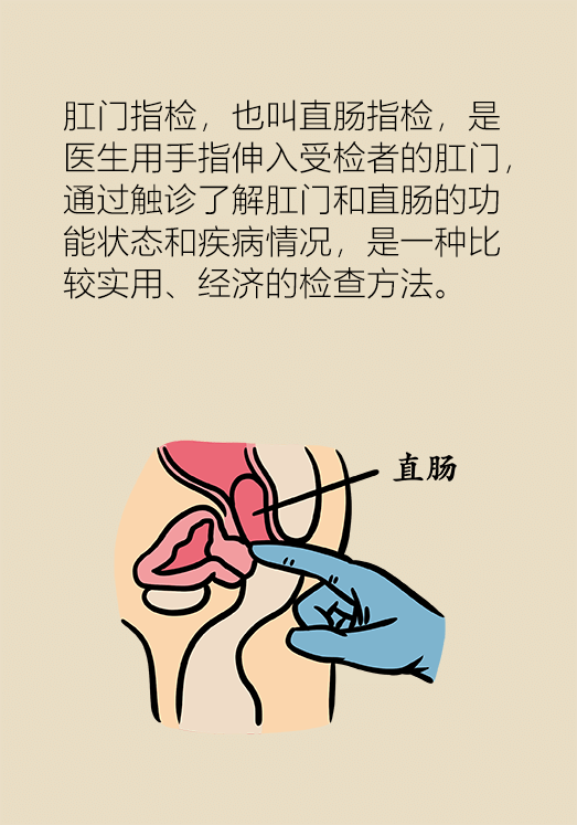 直肠指检预防早期直肠癌最不靠谱真正有用的是这个