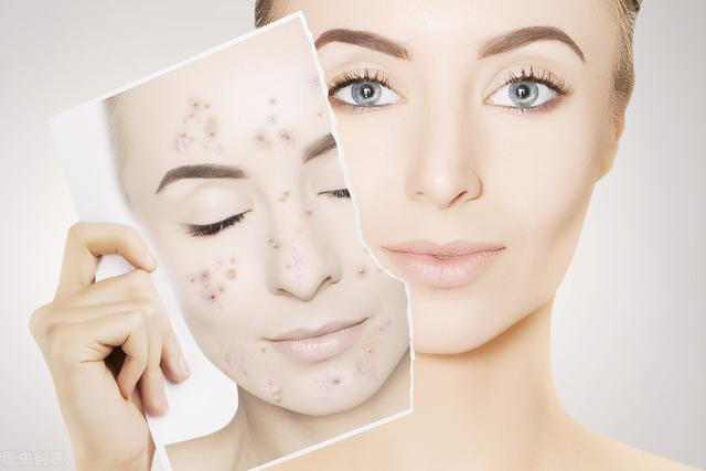 敏感肌肤泛红怎么办中美杜克正确修复方法大公开