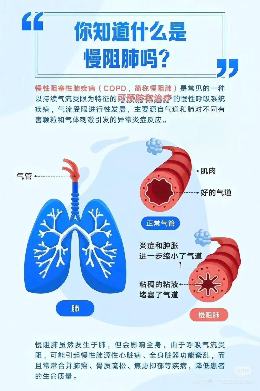 慢阻肺,急需被认识的“沉默的杀手”! - 知乎