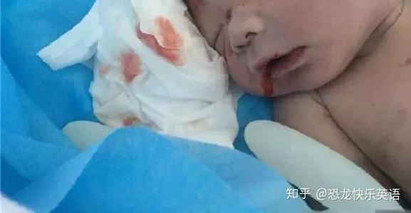 大意了 宝宝摔下床3天后死亡 这些致命伤万万不能忽视 知乎