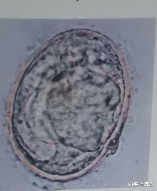 人体寄生虫卵图片