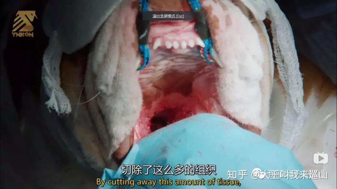 切除掉的组织贝琪接受手术,切除软腭后部的多余组织,并把鼻孔褶皱取出