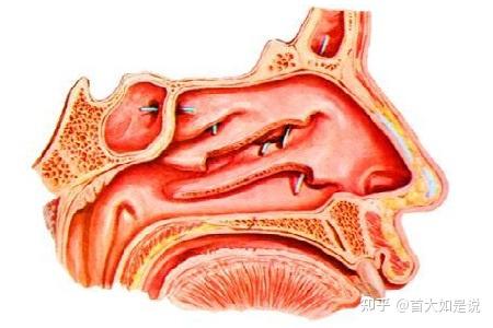 此外,腫瘤所致鼻出血多系腫瘤本身表面潰爛引起,出血程度因腫瘤性質而