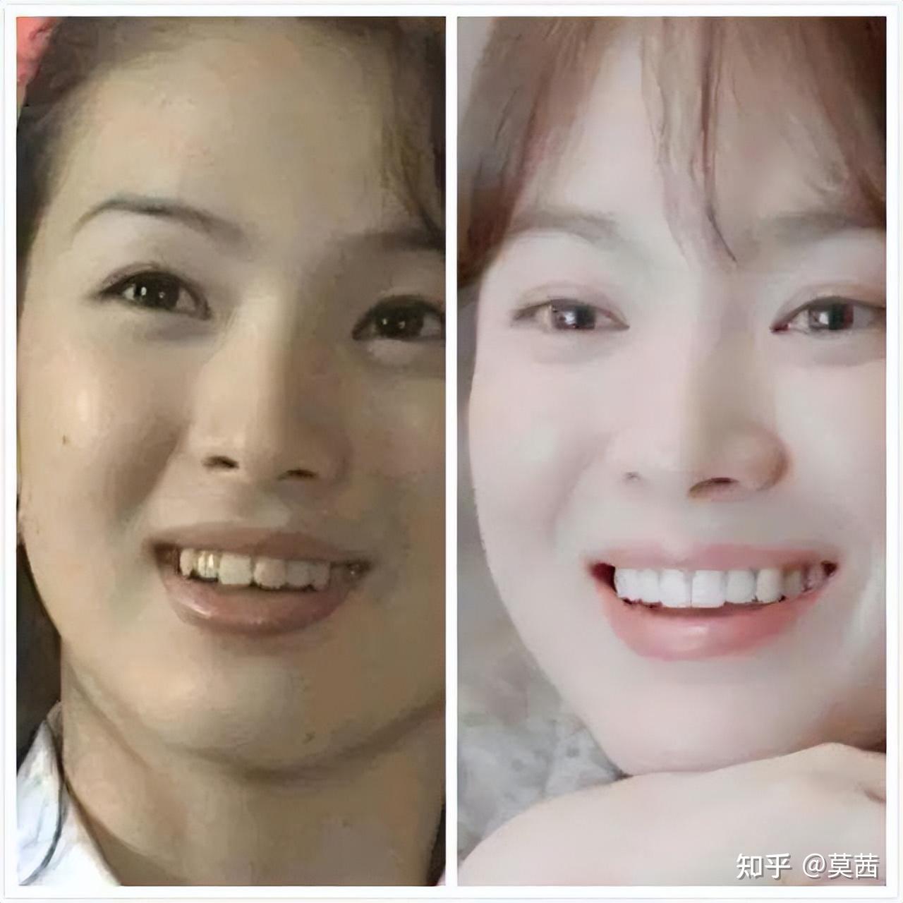 月亮脸才是美貌杀手显苦相像巫婆谢娜杨幂都吃亏在这点